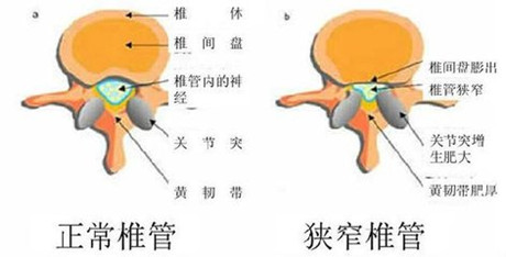 对比图.jpg 对比图.jpg