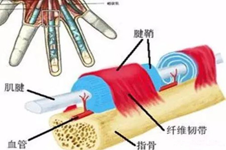 肌腱炎.jpg 肌腱炎.jpg