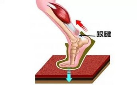 跟腱炎.jpg 跟腱炎.jpg