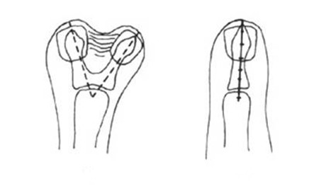 手术2.jpg 手术2.jpg