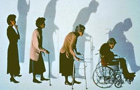 骨质疏松症状.jpg 骨质疏松症状.jpg